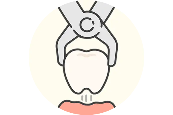 抜歯のリスクを減らせる