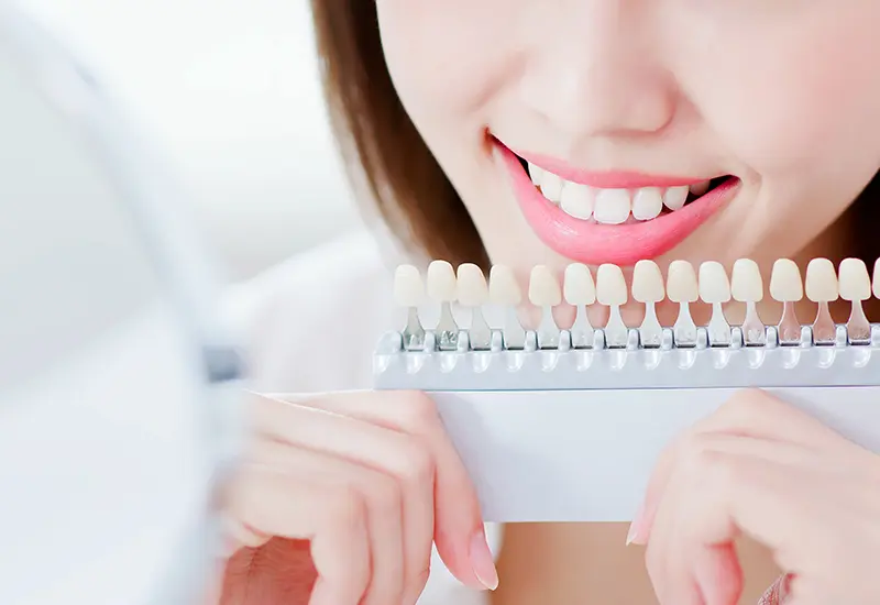 自然な色の歯を得られる