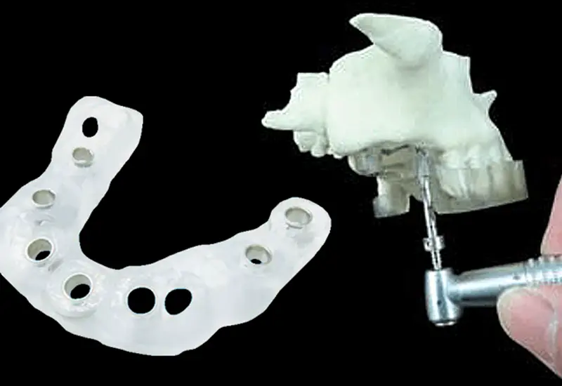 短時間かつ性確な治療