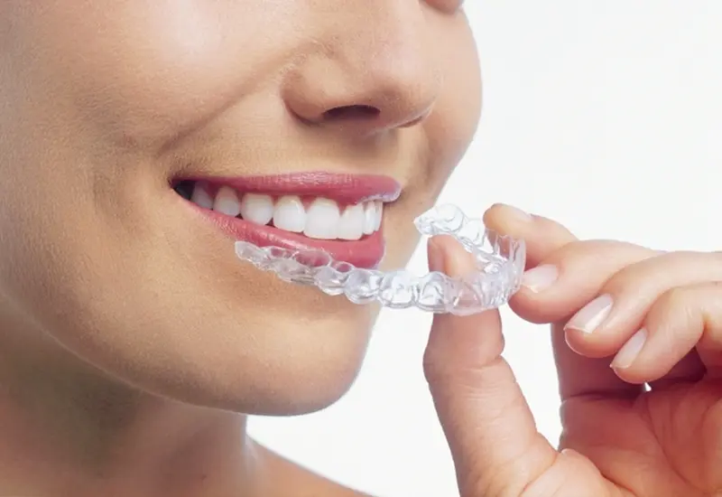 インビザラインGo