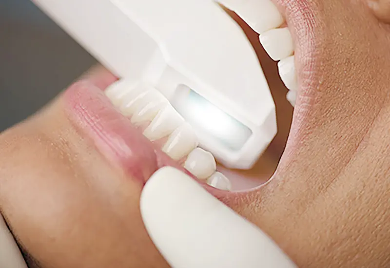 非常にスピーディー