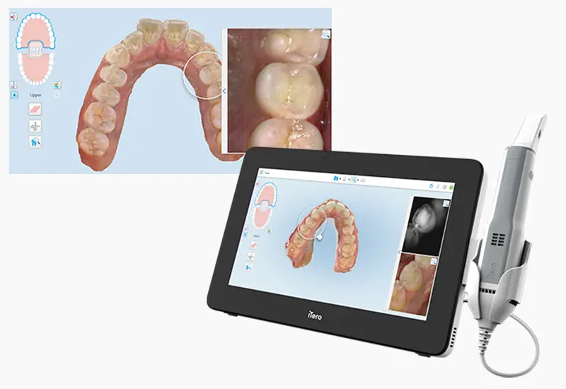 超精密で採り直しリスクゼロ