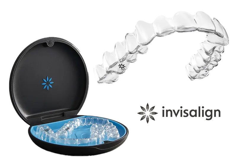 インビザラインのメリット